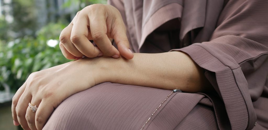 امرأة تشعر بحكّة خفيفة في يدها