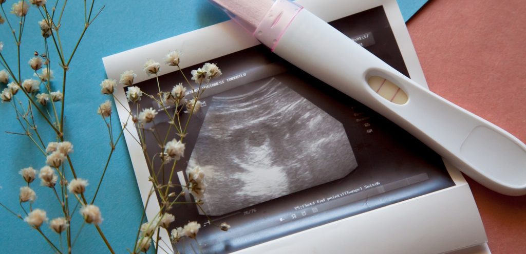 صورة للجنين مع فحص الحمل