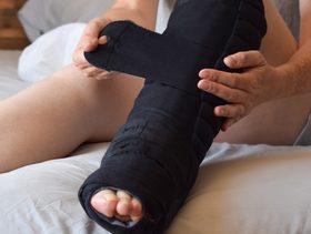 هل يمكن المشي على الرجل المكسورة؟