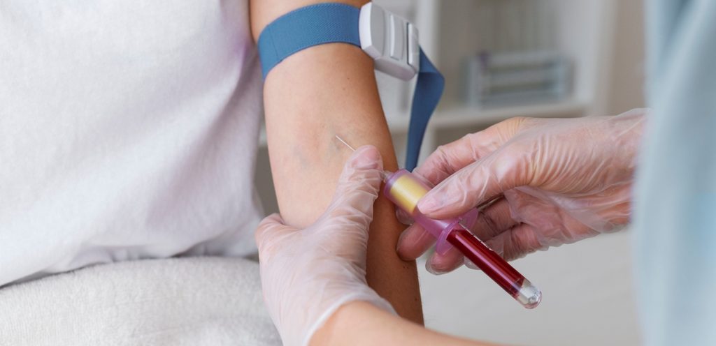 ممرّضة تسحب دم من يد مريضة