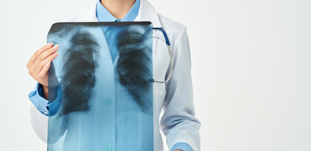 طبيبية تمسك صورة أشعّة للرئتين