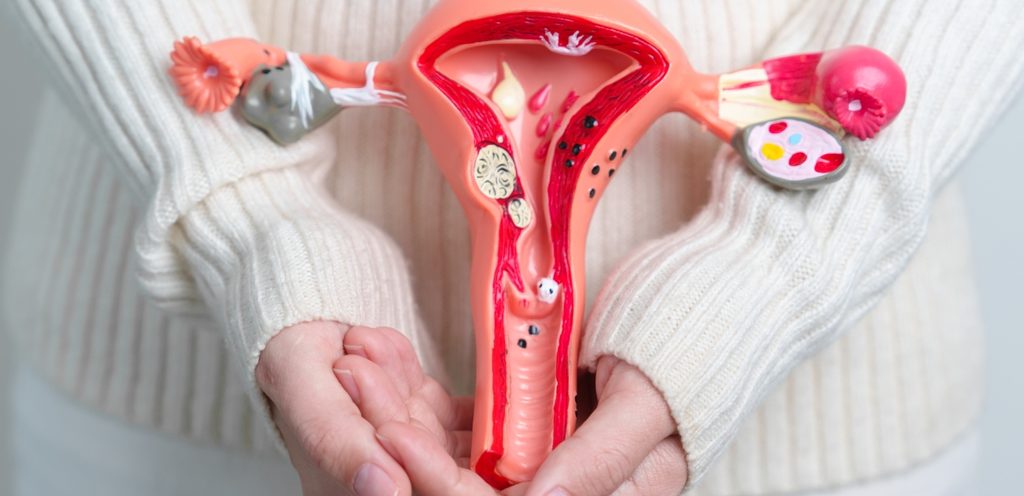 امرأة تمسك مجسّم عن الجهاز التناسلي الأنثوي