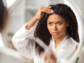 علاج اكزيما الشعر