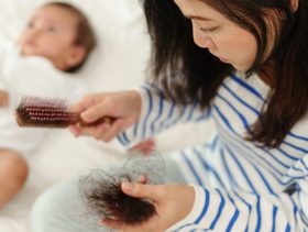 أم تضع دواء الثعلبة على رأس طفلها