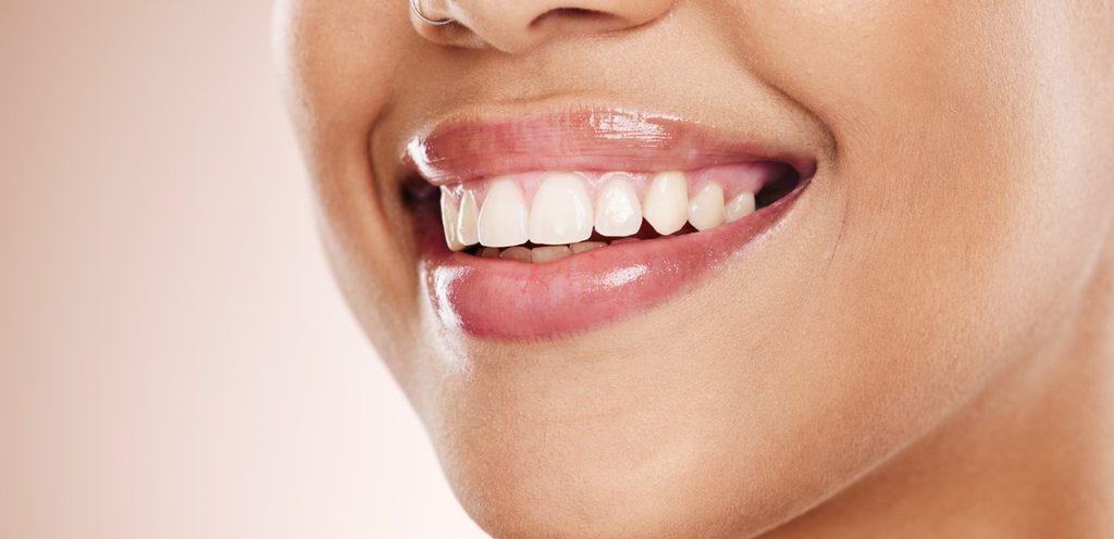 تبييض الاسنان