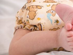 علاج التهاب الحفاضات بالنشا