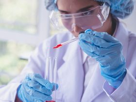 طبيبة تحلل اختبار دم