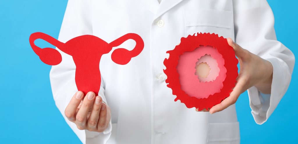 طبيب يمسك شكل بويضة وشكل الجهاز التناسلي الأنثوي