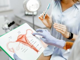 طبيبة توضح عملية استئصال المبايض