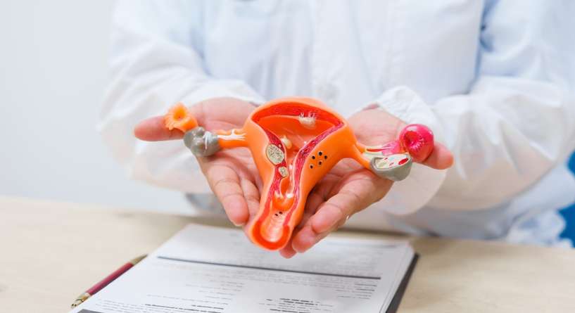 طبيب يحمل مجسم الرحم