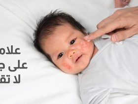 بالفيديو، 7 علامات طبيعية على جسم طفلك لا تقلقي حيالها