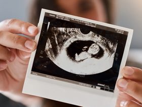 صورة بالموجات فوق الصوتية للجنين