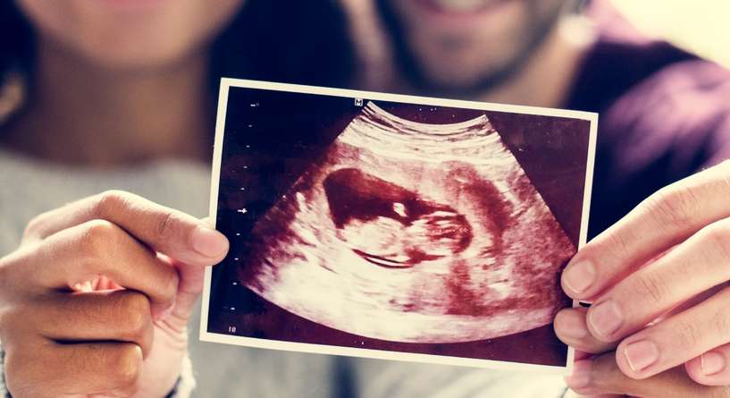 صورة بالموجات فوق الصوتية للجنين