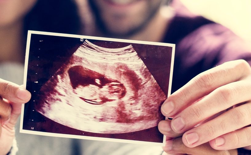 صورة بالموجات فوق الصوتية للجنين