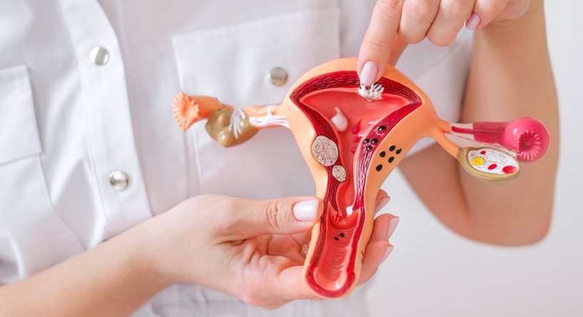 اضرار تضييق المهبل بالليزر