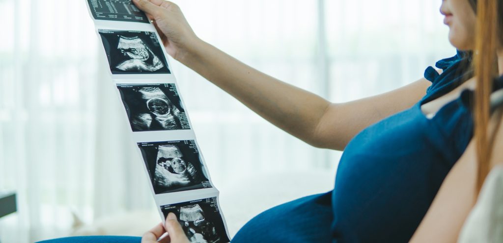 امرأة حامل تمسك صور سونار لجنينها