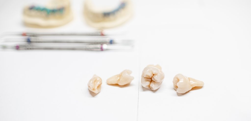 أربعة أسنان ساقطة