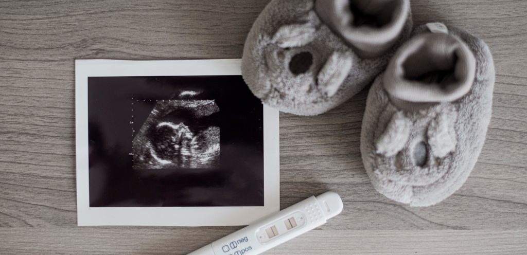 اختبار حمل مع حذاء طفل وصورة سونار