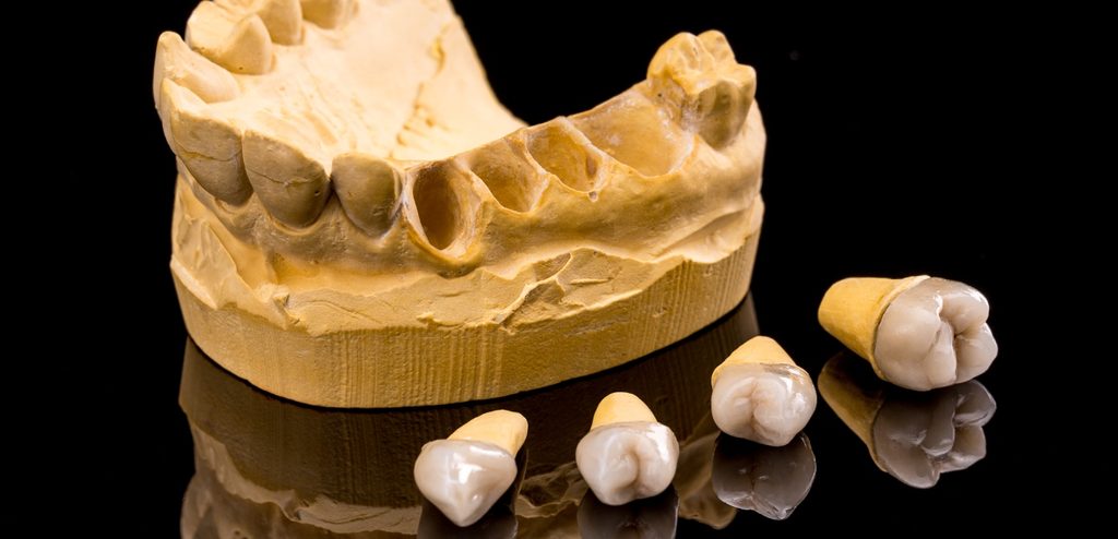 مجسّم أسنان مع أسنان ساقطة