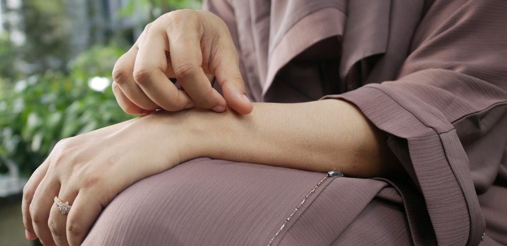 امرأة تعاني من الحكّة في يدها
