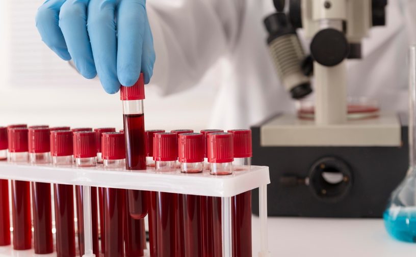 إليكِ القصة الكاملة!