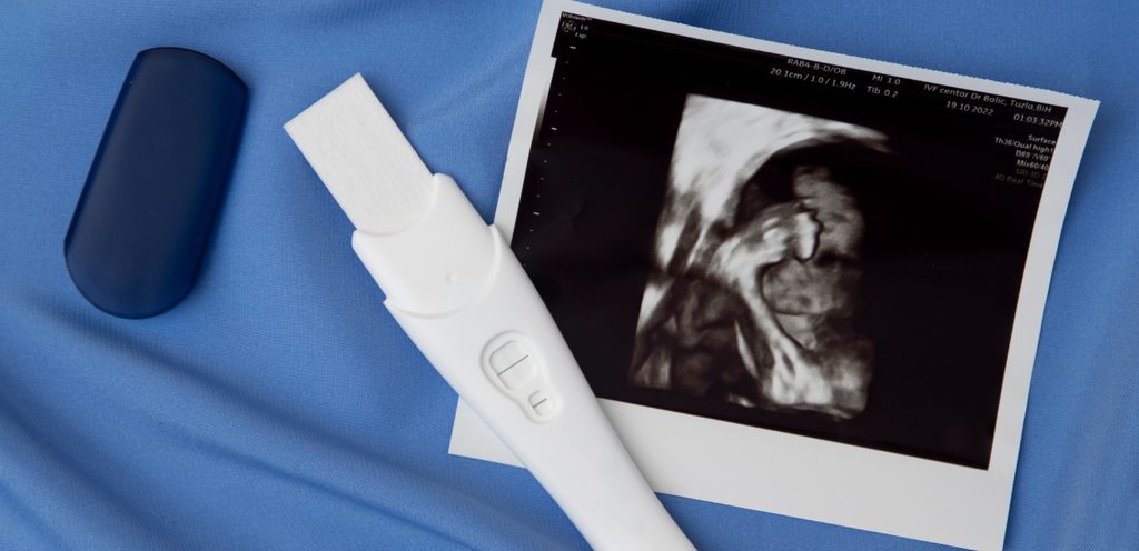 صورة سونار واختبار حمل