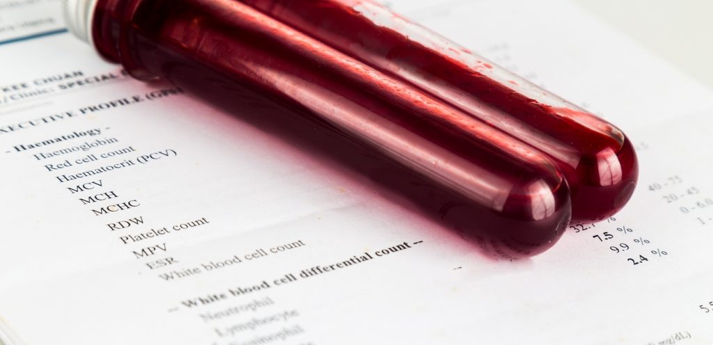 أنبوبان من الدم