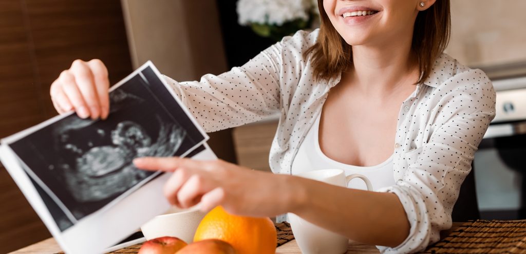 امرأة تمسك صورة سونار للجنين
