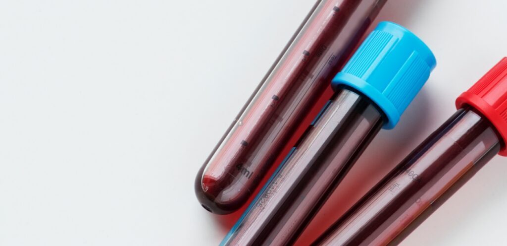 أنابيب من الدم