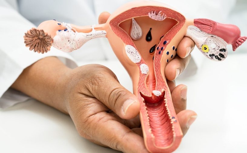 اعراض الالتهابات المهبلية