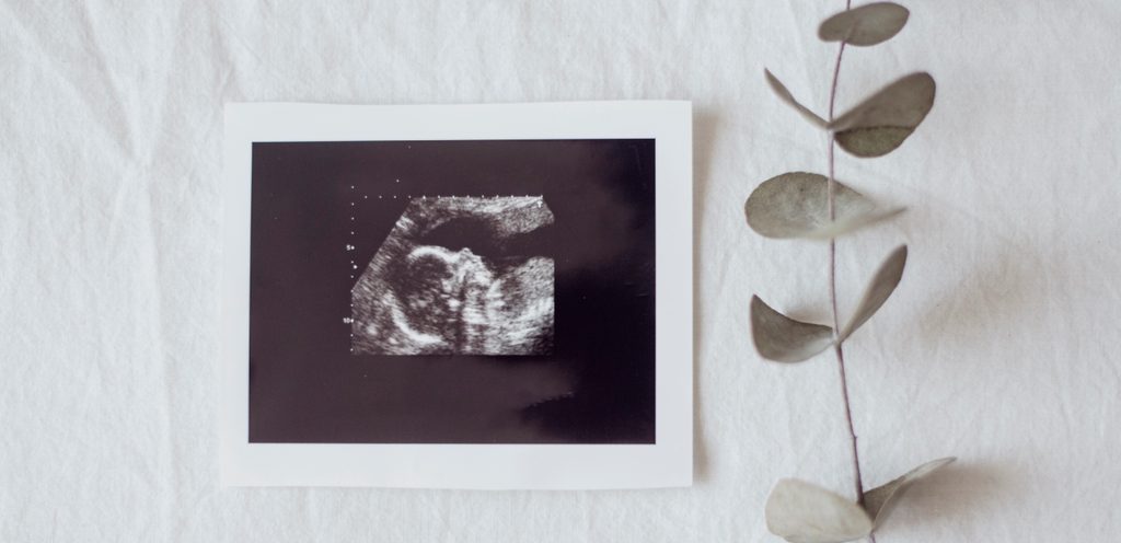 صورة سونار للجنين في الرحم