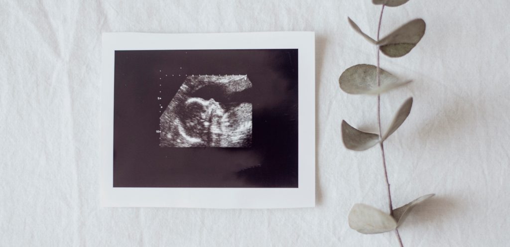 صورة سونار واختبار حمل