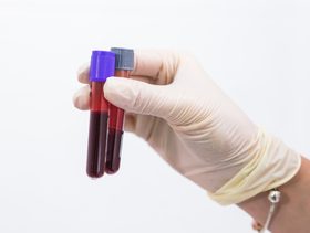 سبب اختلاف فصيلة دم الجنين عن والديه