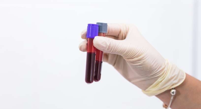 سبب اختلاف فصيلة دم الجنين عن والديه