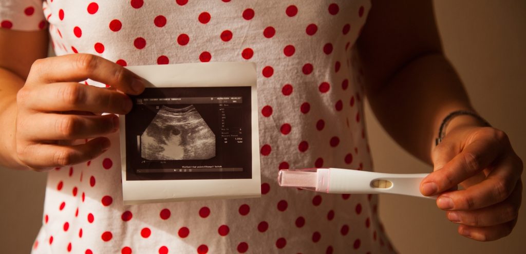 امرأة تمسك صورة سونار للجنين واختبار حمل منزلي