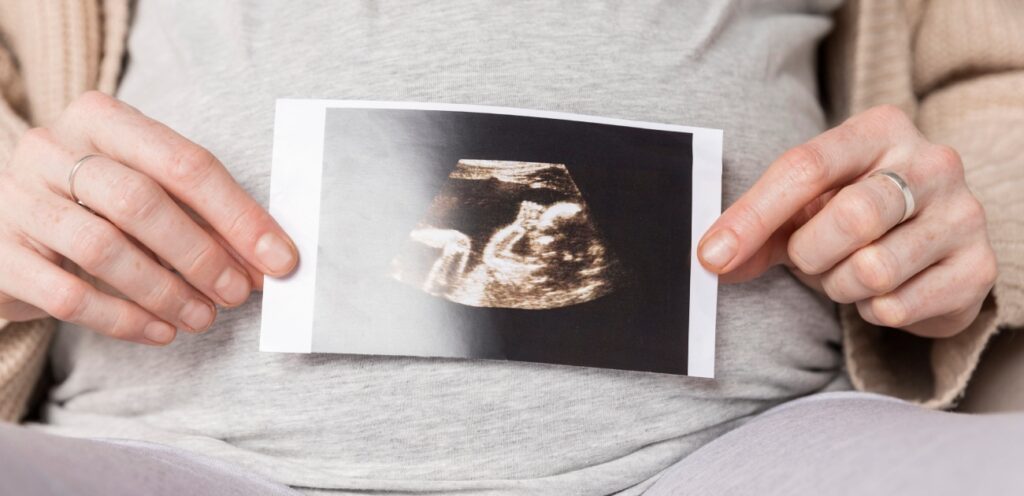 امرأة حامل تمسك صورة سونار