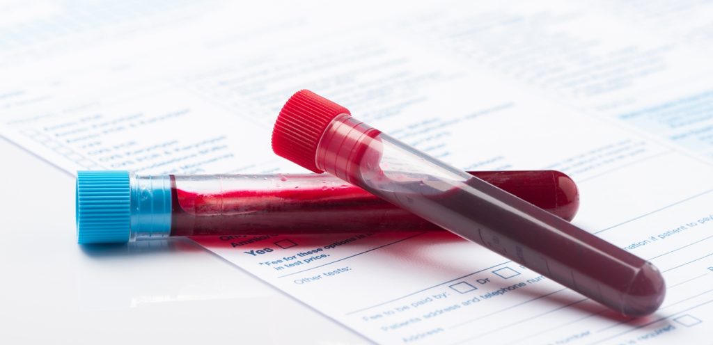 أنبوبان من الدم