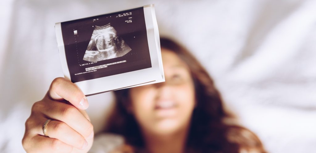 امرأة تمسك صورة سونار للجنين
