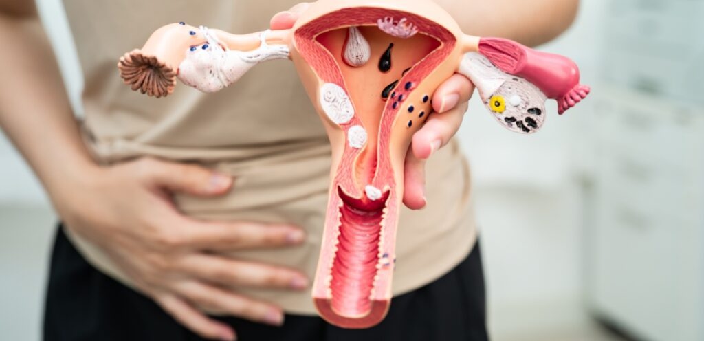 امرأة تضع يدها على بطنها وتمسك مجسّم رحم