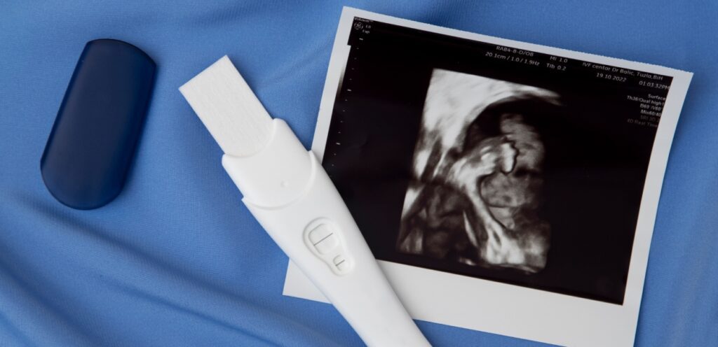 صورة سونار للجنين