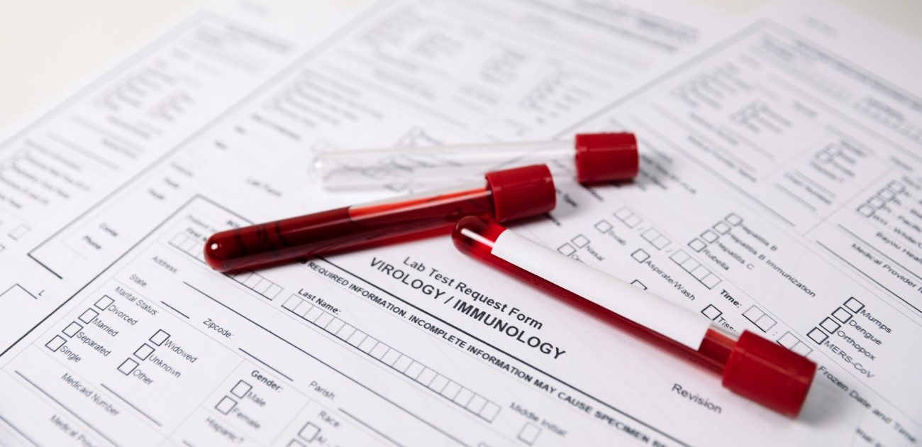 أنبوبان من الدم