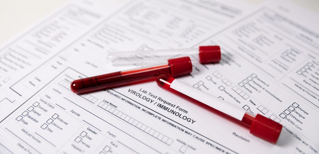 أنبوبان من الدم