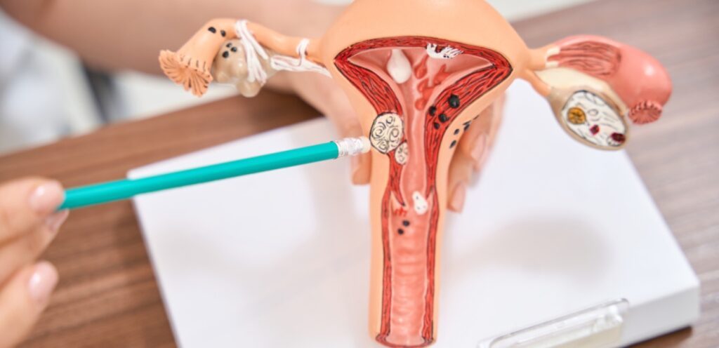 شكل الجهاز التناسلي الأنثوي