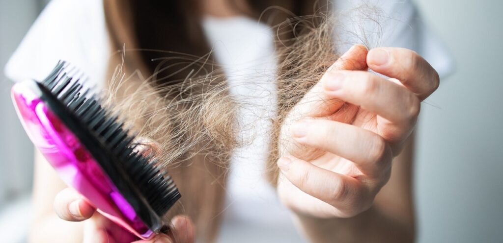 امرأة تعاني من تساقط الشعر