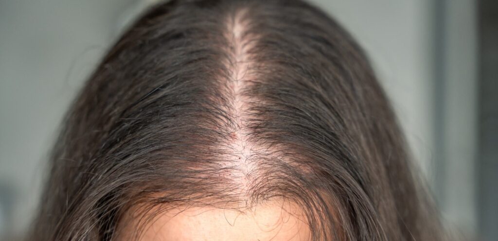 امرأة بشعر خفيف