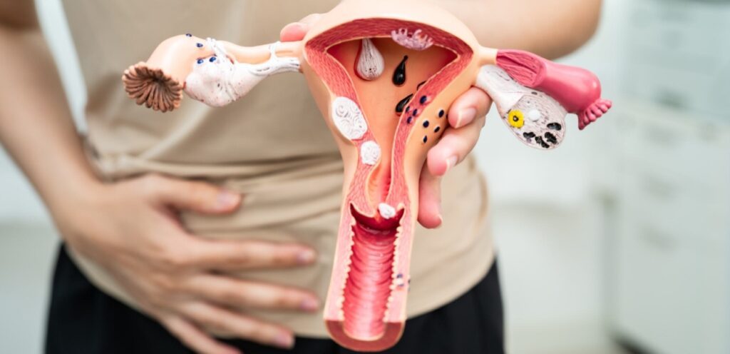 شكل الجهاز التناسلي الأنثوي