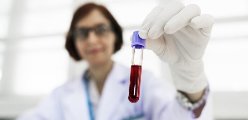 طبيبة تمسك أنبوب دم