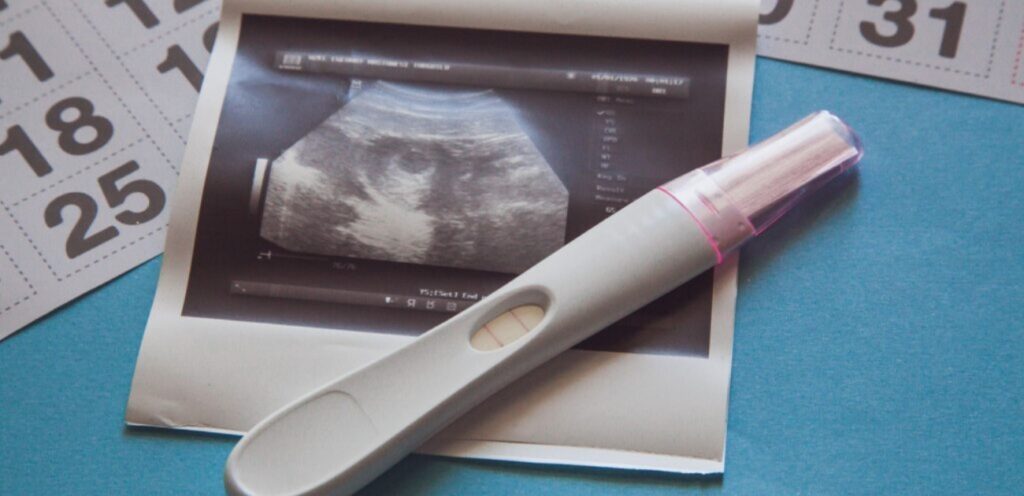 صورة سونار واختبار حمل