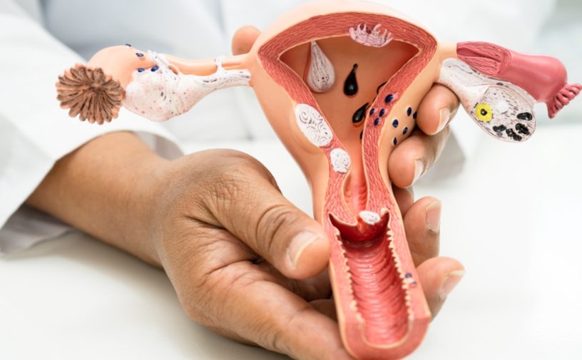 تجربتي مع عملية تضييق المهبل بالليزر