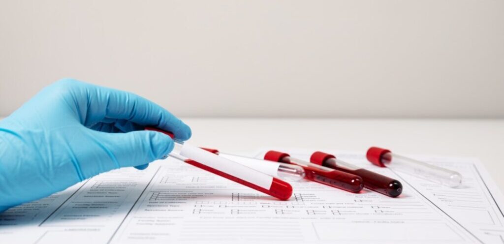 أنابيب من الدم